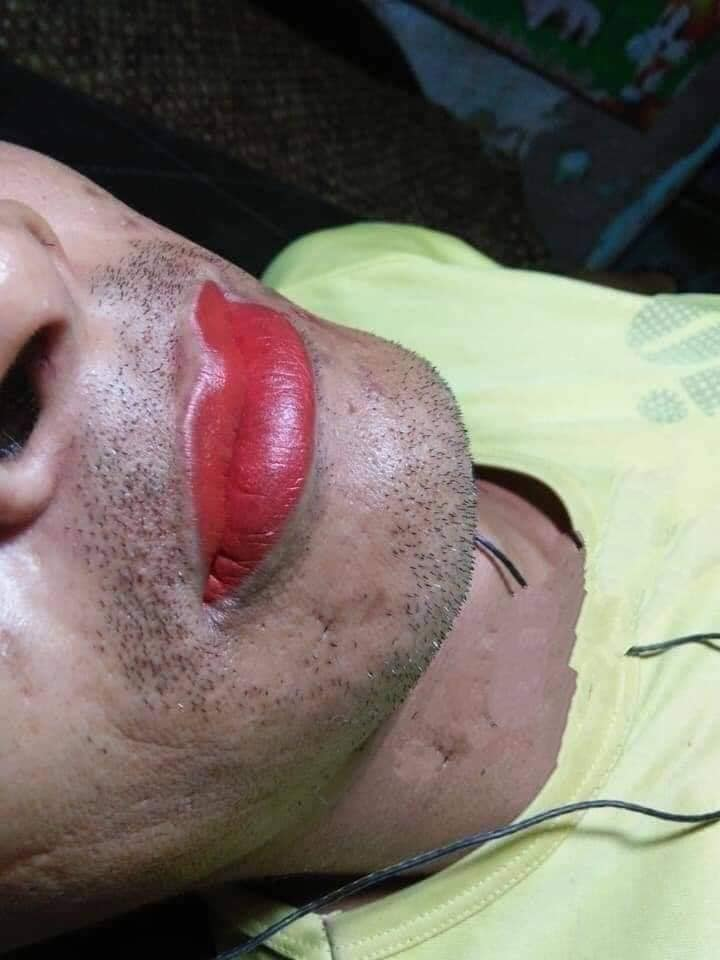 Thủ Thuật Hướng dẫn Cách hạch toán dự phòng giảm giá hàng tồn kho theo TT 200 và 133 Mới nhất 2022 3 4104