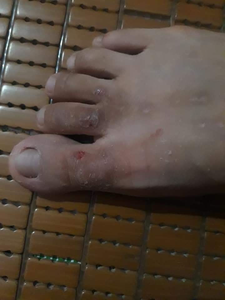 Con tram su nho thay va cac bac tien boi